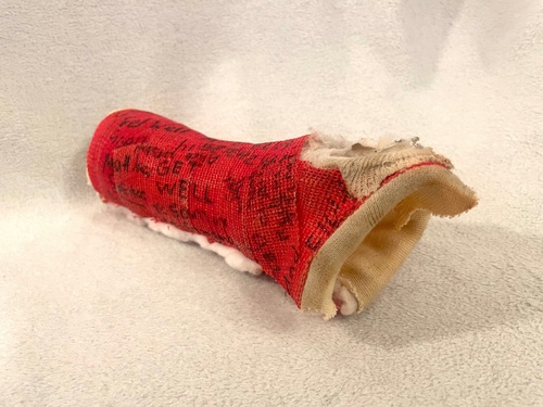 A red cast for a broken arm, cut down the middle, with signatures written on the side in black sharpie.